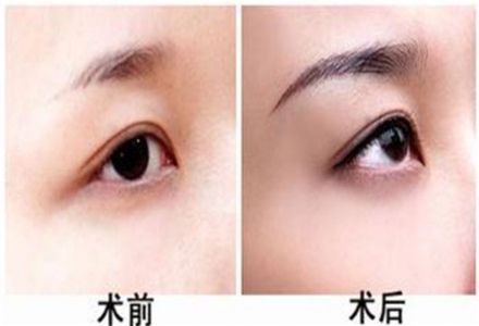 2023煙臺光波去黑痣專家排行前10名排行榜詳解！陳小兵、張曉燕、姜濤別錯過