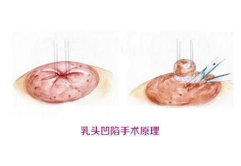 2023承德大拉皮去皺醫(yī)生排名榜top10強(qiáng)實(shí)力榜單！堵頂云、王銘、汪洋當(dāng)屬當(dāng)?shù)孛麣飧?>
									</a>
									<div   id=