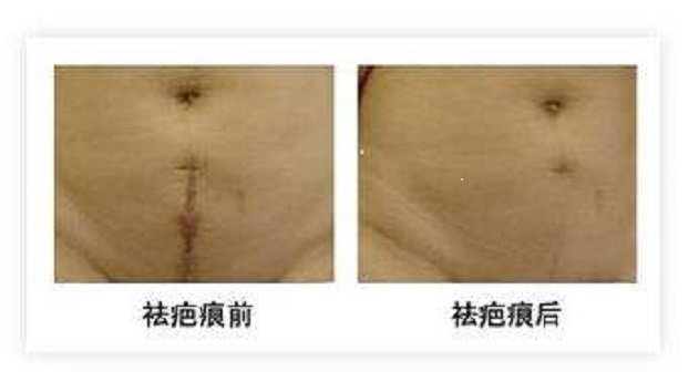 2023深圳光子去除雀斑排行榜top10強專家宣告！劉遷、范小龍、楊淑霞口碑評價公布