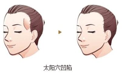 2023南昌激光治療血管瘤醫(yī)生前10強口碑榜匯總綜合！雷浚嶸、王忠干、李丹人氣對比選擇