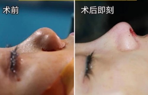 2023大連細(xì)胞激活動(dòng)態(tài)細(xì)紋醫(yī)生排行榜top10強(qiáng)優(yōu)選分享，車(chē)敏秀、劉光穎、李晶技術(shù)實(shí)力不斷攀升