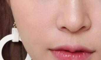 2023廣州E光去紅血絲排名前10位的醫(yī)生評價(jià)好不好？凌文娟、何小華、魯峰口碑專家當(dāng)?shù)爻鋈?>
										</a>
										<div   id=