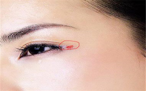 2023無(wú)錫手術(shù)改善木偶紋權(quán)威醫(yī)生上榜前幾同城精選！陳光平、聞長(zhǎng)銓、歐陽(yáng)黎平口碑實(shí)力對(duì)比速看