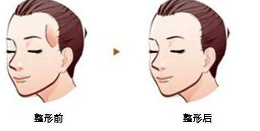 2023太原眉部矯正前十醫(yī)生排名縱評(píng)！馮光、白院長、李永生實(shí)力不耐！