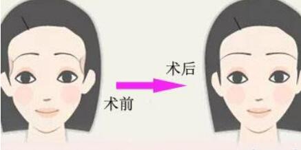 2023鎮(zhèn)江黃金微針祛口周紋醫(yī)生強(qiáng)榜top10強(qiáng)人氣一覽！李巍、徐斌、王心音公立、私立均人氣很旺！