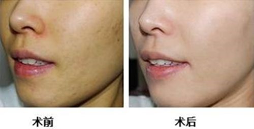 2023紹興脂肪精雕強(qiáng)榜top10強(qiáng)的醫(yī)生排行發(fā)布！張雙喜、李俊霞、張留陽都是經(jīng)驗(yàn)豐富的人氣醫(yī)生！