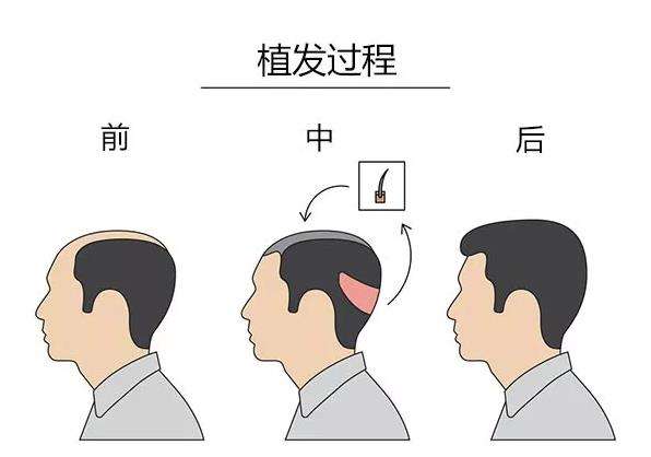 2023沈陽(yáng)光電去疤口碑榜前十名的醫(yī)生哪里醫(yī)院比較好？曹永茂、曹政、李夢(mèng)穎點(diǎn)擊查看實(shí)力如何