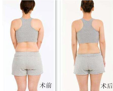 驚喜分享：宋俊嶺雙眼皮，浪漫撩動內(nèi)心，帶來我與男神的浪漫告白