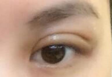 深圳比較好的鼻修復(fù)專家推薦！醫(yī)術(shù)高超，擅長(zhǎng)各類項(xiàng)目詳解！