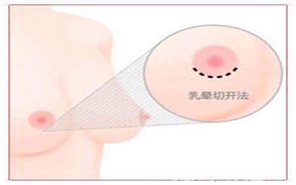 2023上海眼角修復(fù)手術(shù)醫(yī)生top10強強榜選都值得！王毅敏、蘇薇潔、王培生實力口碑廣受好評