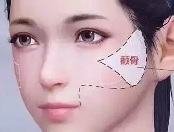 2023?？谄つw松弛下垂改善醫(yī)生top10排行榜專家點(diǎn)評！楊鵬、羅勇、黃美紅雄踞前三
