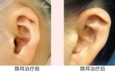 2023常德高難度眼部整形前10強(qiáng)專(zhuān)家排行供參考！龍劍虹、陳勇、邰菂口碑技術(shù)兼具