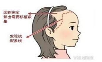 2023哈爾濱皺紋打肉毒素醫(yī)生TOP10強(qiáng)排行匯總！穆蘭花、盧林鳳、李國良快來看看這些專家吧！
