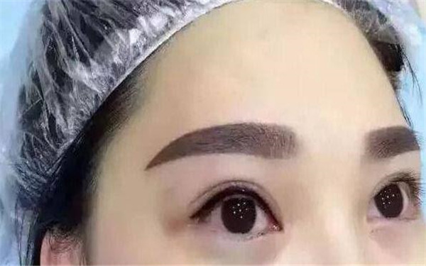 2023蘇州生長(zhǎng)紋線雕提升top10強(qiáng)醫(yī)生口碑榜查詢，楊國(guó)正、夏曉玲、張東旭口碑實(shí)力都不錯(cuò)~