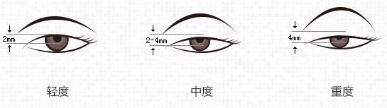 2023西安點(diǎn)陣激光去除妊娠紋排名前十名的醫(yī)生技術(shù)一絕！胡忠民、彭元、朱瑩名氣大實(shí)力強(qiáng)