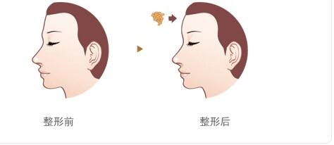 2023淄博祛除眼部皺紋醫(yī)生TOP10排名熱門醫(yī)生推薦！許克明、王苓、于洪亮資質(zhì)權(quán)威