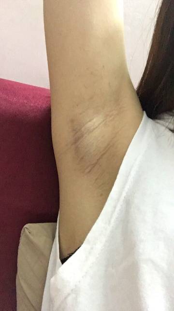 2023廣州阿爾法美眼權(quán)威醫(yī)生排名前十位隆重發(fā)布！李勤、劉志剛、李明誰能穩(wěn)居榜首