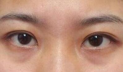 2023常德溶脂針腹部注射醫(yī)生排名前10強(qiáng)排名，馮文華、肖曦、馮文華解答您的疑問(wèn)