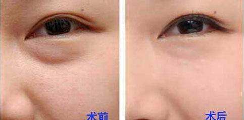 2023天津改善臉部松弛在榜名單前十強(qiáng)醫(yī)生新鮮榜單出爐！儲(chǔ)君、張瓈絹、韓琦這些醫(yī)生技術(shù)頂呱呱，總有一個(gè)適合你