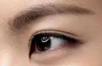 2023三明玻尿酸眉間紋填充醫(yī)生評(píng)分前10強(qiáng)獨(dú)家公布！馬靜、何歡、羅狄等連續(xù)上榜