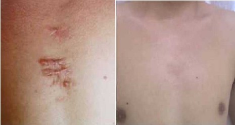 潘紅偉吸脂效果如何？手術(shù)規(guī)模大嗎？來自成都的整形醫(yī)生聲譽(yù)調(diào)查！