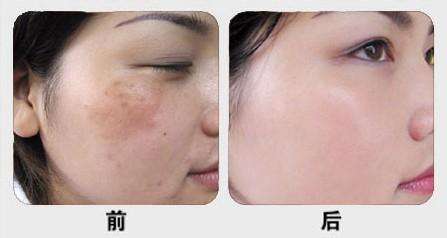 尋覓中國雙眼皮修復(fù)專家，這些醫(yī)生值得預(yù)約！