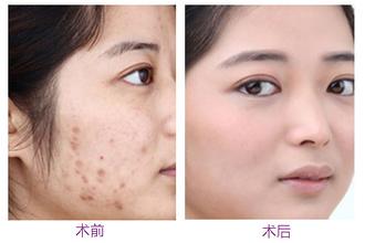 揭秘上海眼部整形界的專家，技術(shù)實(shí)力突出，你了解嗎？