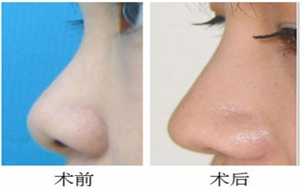 廣州鄧正軍拉皮手術(shù)，綜合醫(yī)生點(diǎn)評、費(fèi)用及就診地點(diǎn)