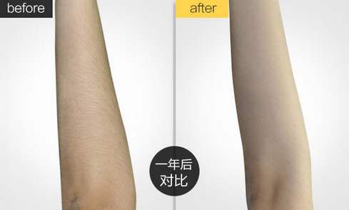 提升你的魅力品質(zhì)，探索重慶天妃整形美容有無(wú)法匹敵的激光美容術(shù)