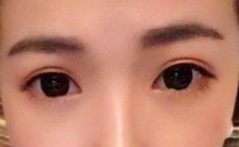 鄧正軍醫(yī)生青睞干凈的奧美定取法？臨床數(shù)據(jù)及病例反饋讓清奧成為不二選擇！