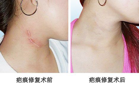 上海劉雙立醫(yī)生：隆鼻效果自然還是出眾？手術(shù)風(fēng)格與信息簡(jiǎn)介揭秘