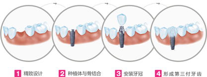 米亞整形醫(yī)院：李繼華教授V-line潮流-值得期待的效果