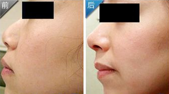 北京華韓整形醫(yī)院：探秘閆學(xué)華的成人矯正創(chuàng)新技術(shù)