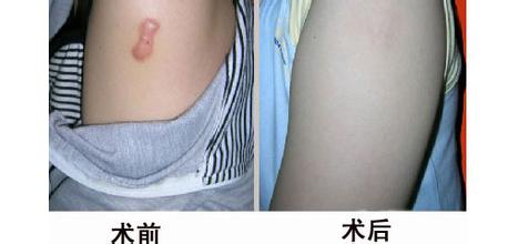 北京華韓高亞東小拉皮醫(yī)生背景介紹、專業(yè)技能及價(jià)格明細(xì)
