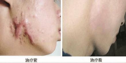 上海李鴻君鼻子塑造風(fēng)格及醫(yī)生簡介+價格淺析！