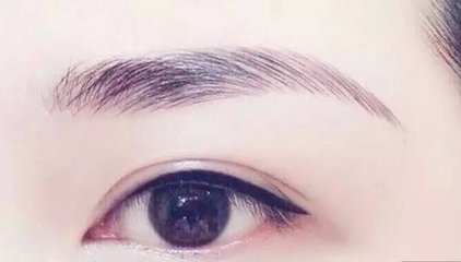上海喜美鄒亞光醫(yī)生的技術(shù)如何？從實(shí)力和口碑角度來分析雙眼皮效果對比