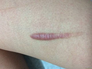 鄧正軍醫(yī)生的整形技術(shù)有多成熟？朝天鼻手術(shù)的后果如何？