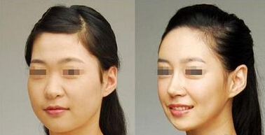 中山一院整形外科，專家資料大曝光！實(shí)力縱橫醫(yī)界，你不可錯(cuò)過(guò)！
