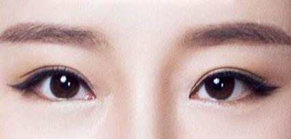 國內(nèi)療效卓越的脂肪填充醫(yī)生Top5，王明利、馮斌和王世虎等5位強者角逐