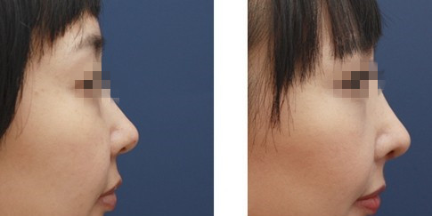 上海九醫(yī)院整形科醫(yī)生團(tuán)隊(duì)介紹丨名單及地址一覽