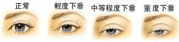 上海鼻部整形專(zhuān)家盤(pán)點(diǎn)，揭秘受歡迎的鼻王之謎