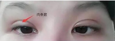 上海九院的顧斌醫(yī)生：雙眼皮風(fēng)格考究、技術(shù)過硬，案例分享值得期待