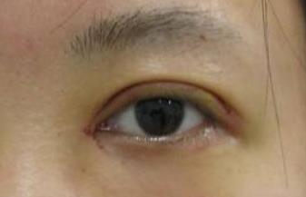 上海詮韓醫(yī)療美容醫(yī)院中國美容界的專家方躍明簡(jiǎn)介
