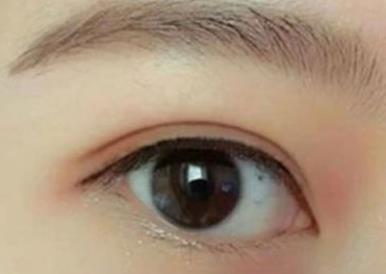 西京醫(yī)院雙眼皮手術(shù)，這些醫(yī)生值得信賴