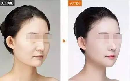 上海哪位專業(yè)醫(yī)生擅長雙眼皮修復(fù)？牛勇敢、張余光或楊亞益？
