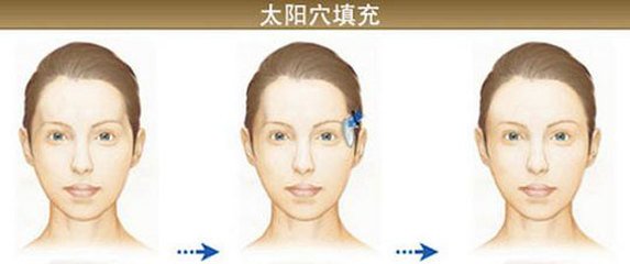 鄭州哪些醫(yī)生在假體隆胸技術(shù)上備受贊譽(yù)？點(diǎn)擊查看！