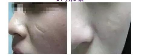 姜宇祿醫(yī)生：醫(yī)術(shù)精湛與鼻綜合整形的解密