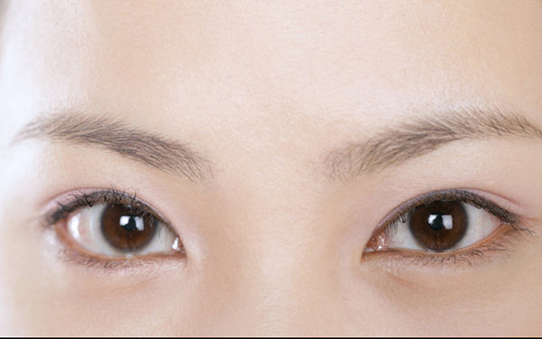 深圳弘美整形醫(yī)院：熊文學(xué)醫(yī)師精準(zhǔn)技術(shù)，雙眼皮割眼皮新潮流