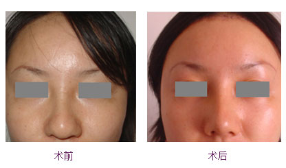 北京朱金成醫(yī)生的醫(yī)療技術(shù)值得信賴