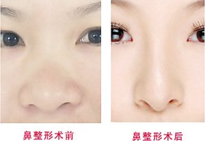 楊鵬高：上海九院整形醫(yī)術(shù)強悍！祛疤案例大揭秘，效果驚艷！